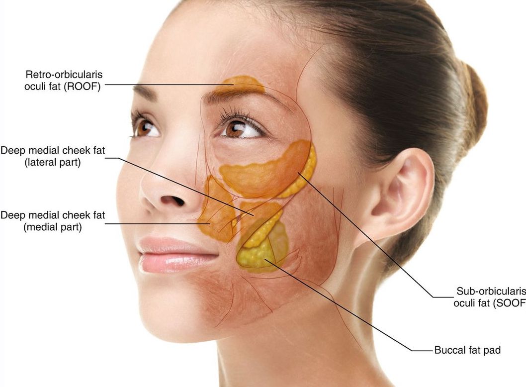 Buccal facial fat removal: Lose now pay later - O U M E R E