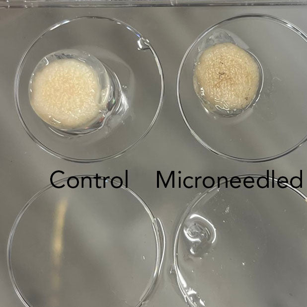 Microneedling decayed, thinned and discolored the surface of skin in human skin specimens - O U M E R E